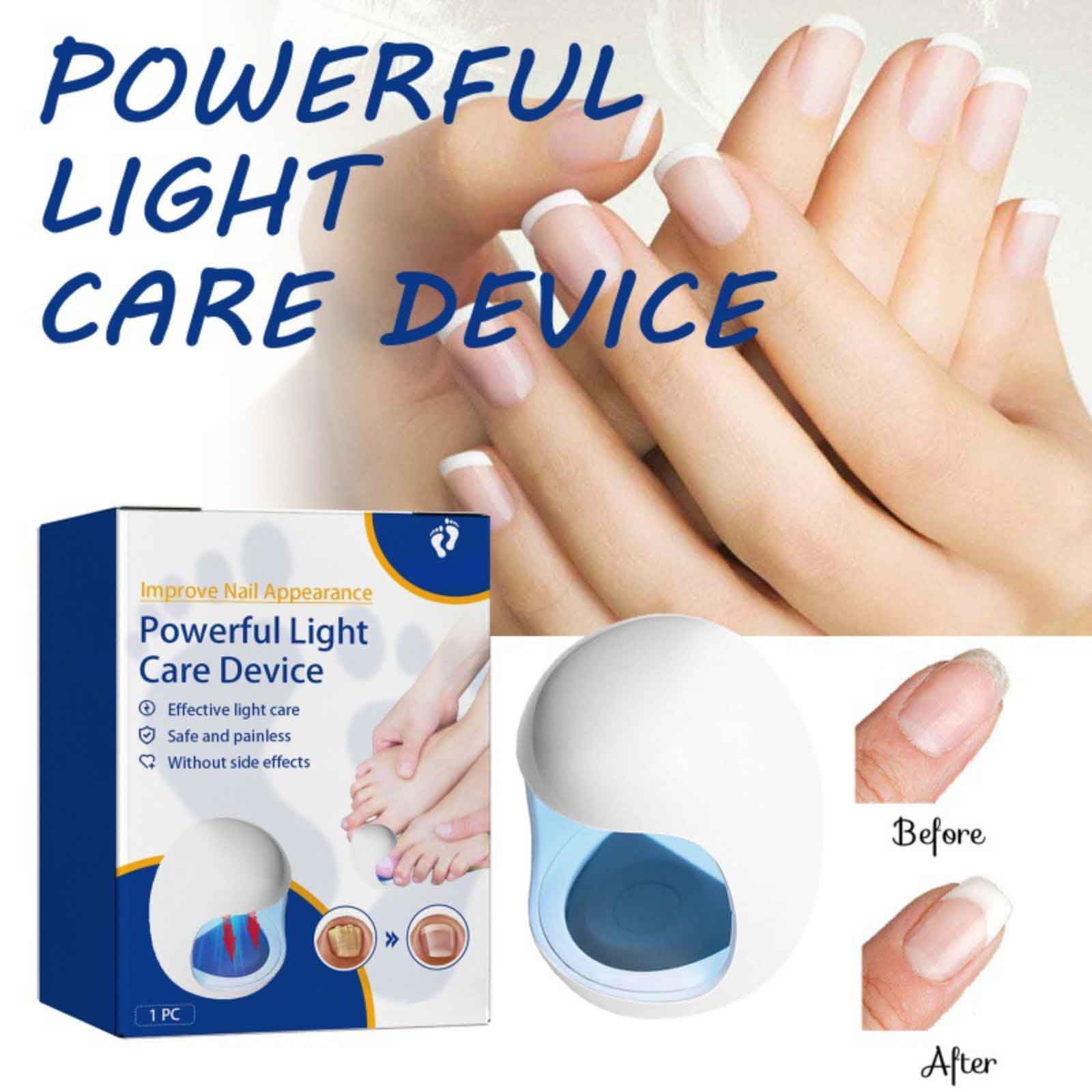 CENGZISHU Convenient Nail Care Device Non Invasive Cleansing Easy To