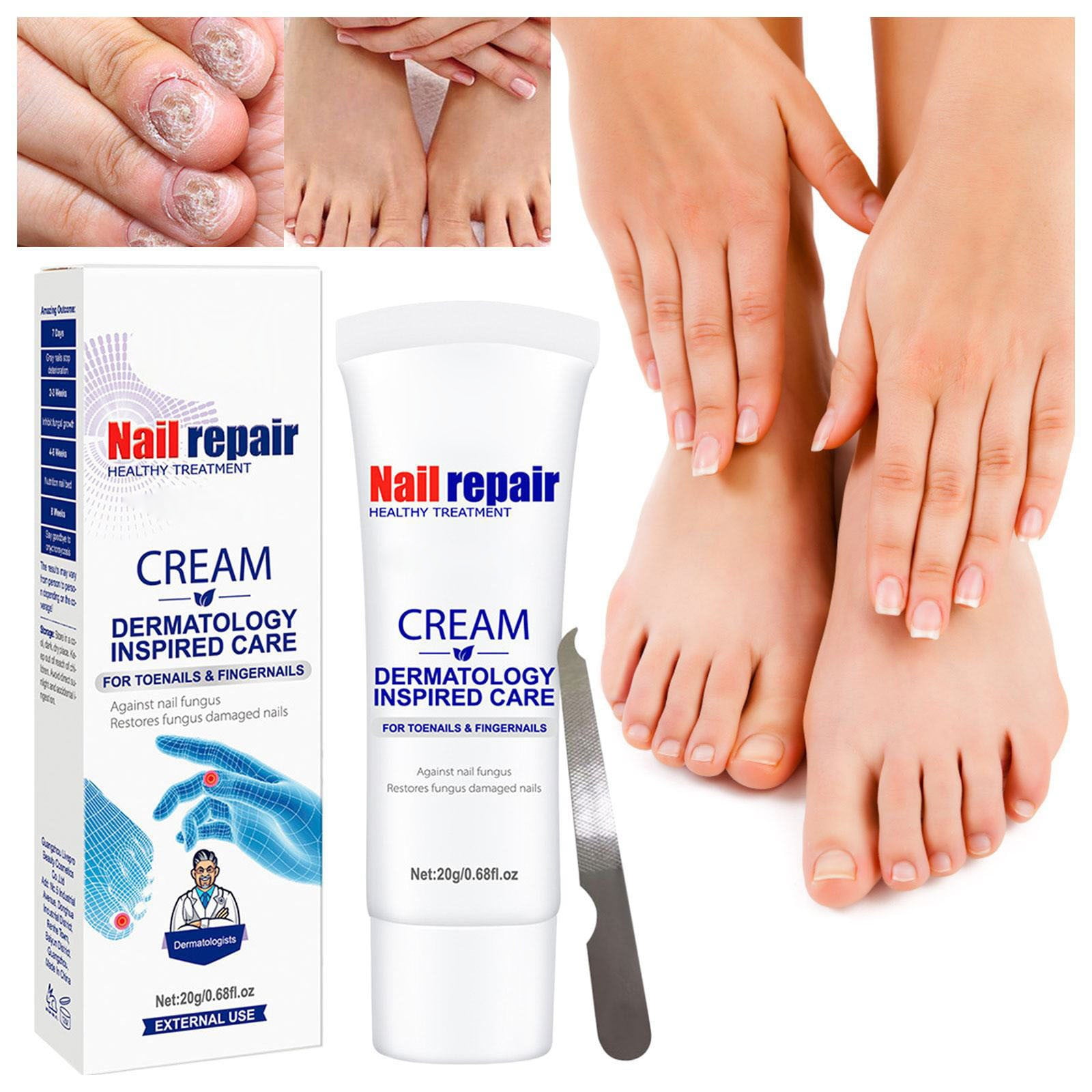 CENGZISHU Nail Effective Toenail Gel Foot Nail Growth Cuticle The