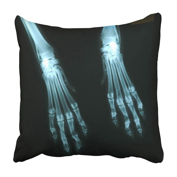 CMFUN Animal X Ray Feet Dog Digital Radiography Bones Expose Film Imaging Inside Pillowcase 16x16 inch