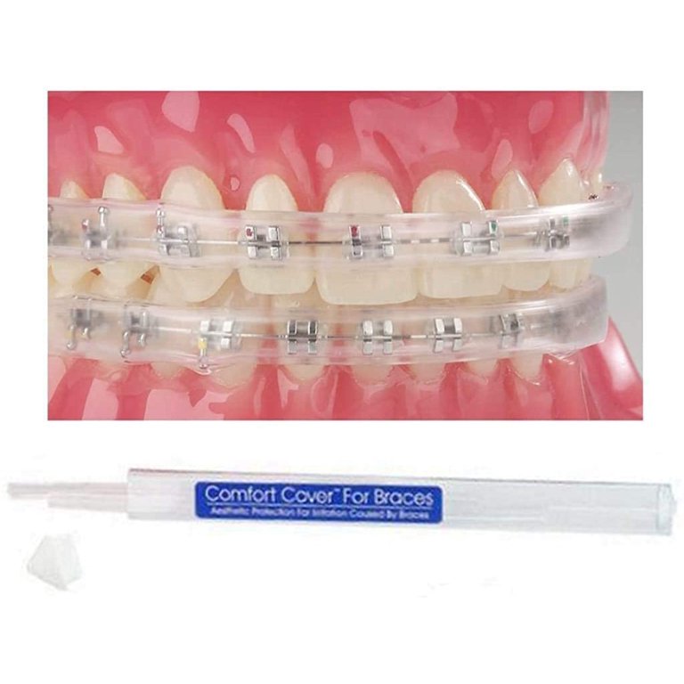 Braces Mouthguard Top And Bottom Discounted Online www.meesenburg.kz