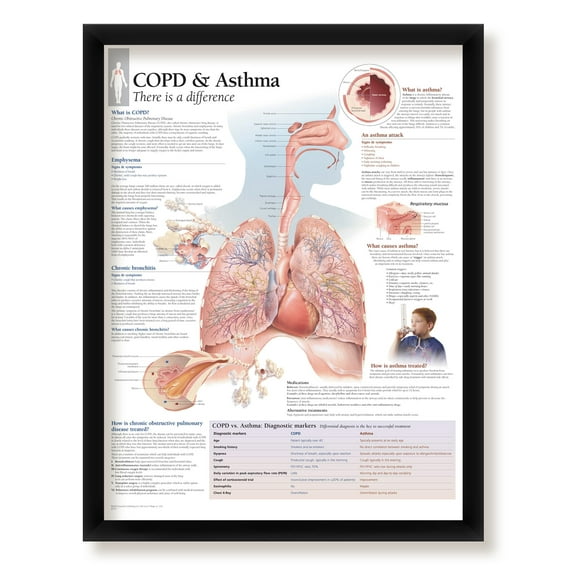 COPD and Asthma Framed Medical Educational Informational Poster Diagram Doctors Office School Classroom 22x28 Inches