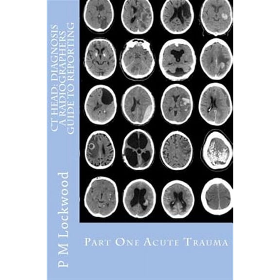 CT Head: DIAGNOSIS A Radiographers Guide To Reporting Part 1 Acute Trauma: Part One Acute Trauma (Paperback)