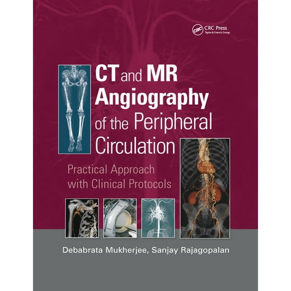 CT and MR Angiography of the Peripheral Circulation: Practical Approach with Clinical Protocols, (Paperback)