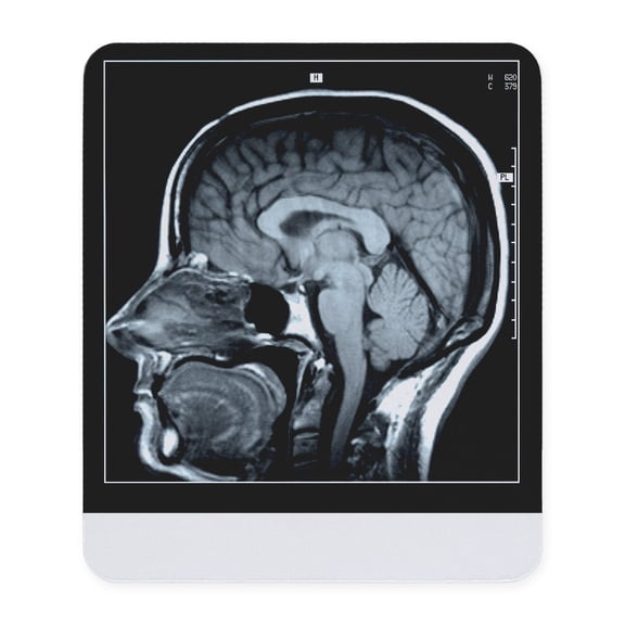 CafePress - Get Your Head Examined Xray Mousepad - Non-slip Rubber Mousepad, Gaming Mouse Pad
