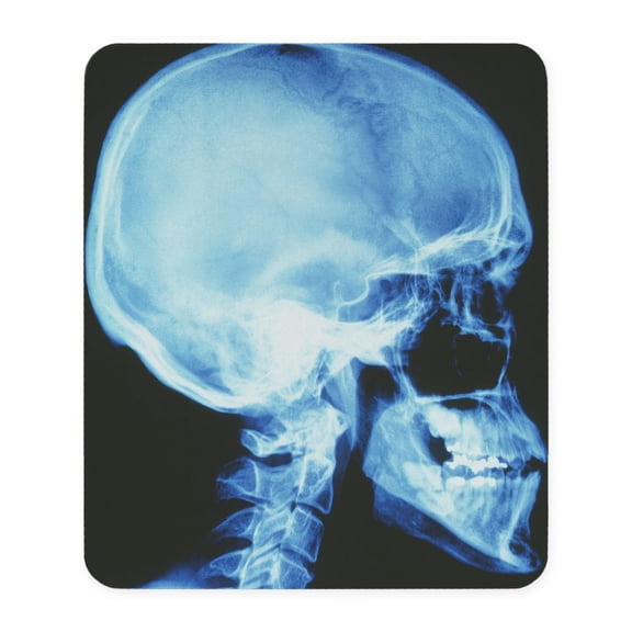 CafePress - Skull X Ray Mousepad - Non-slip Rubber Mousepad, Gaming Mouse Pad