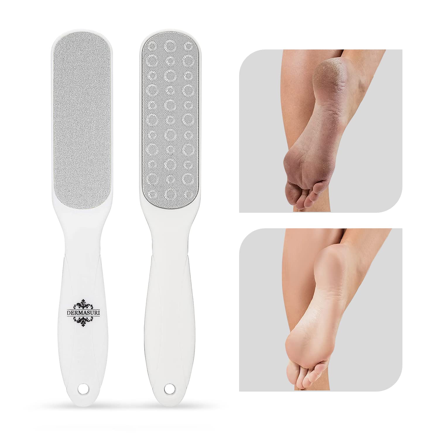 Equate Liquid Corn & Callus Remover with Cushions, 0.33 fl oz