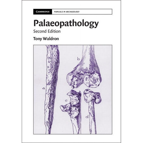 Cambridge Manuals in Archaeology Palaeopathology, (Hardcover)