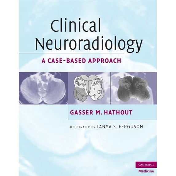 Pre-Owned Clinical Neuroradiology: A Case-Based Approach (Hardcover) 0521600545 9780521600545