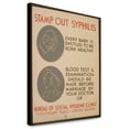 thumbnail image 1 of Canvas Print: Stamp Out Syphilis Every Baby Is Entitled To Be Born Healthy, 1 of 3