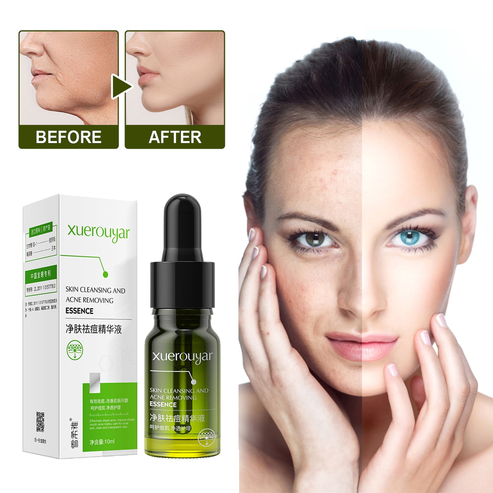 Capebale Brightening Serum, Bottle Salicylic Acide Essence 10ML and