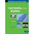 thumbnail image 1 of Carcinoma of the Bladder (Hardcover) by David MacVicar, 1 of 1