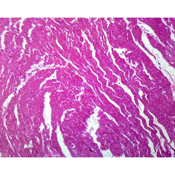 Cardiac Muscle, Human; Cross Section; H&E Stain by Go Science Crazy