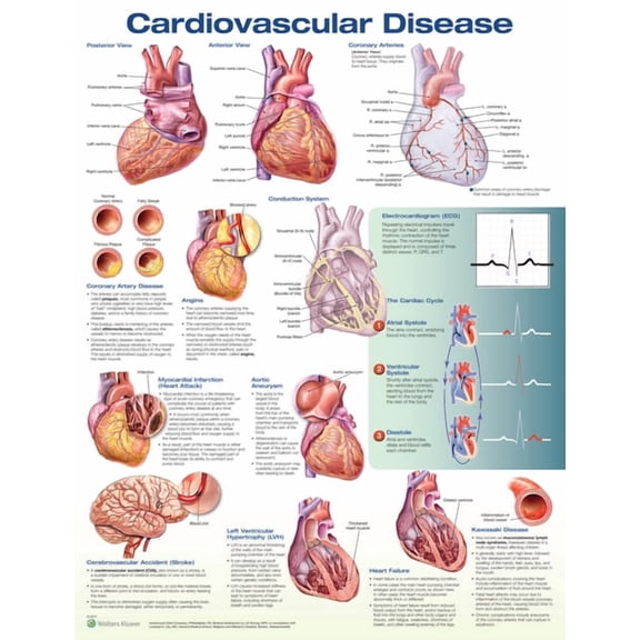 Cardiovascular Disease