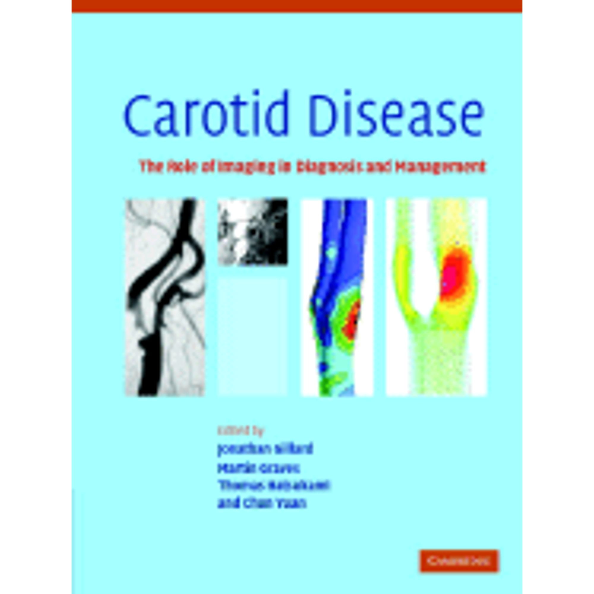 Pre-Owned Carotid Disease: The Role of Imaging in Diagnosis and ...