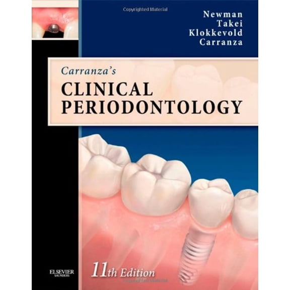 Pre-Owned Carranza's Clinical Periodontology Expert Consult: Text with Continually Updated Online Reference (Hardcover) 1437704166 9781437704167