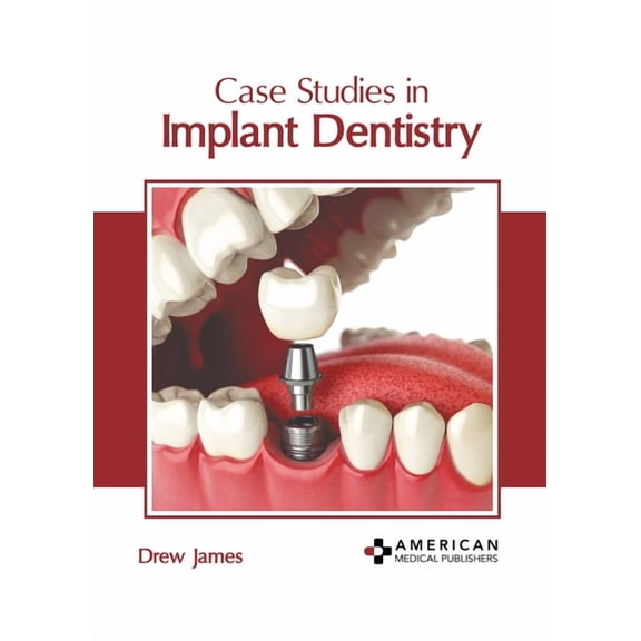 Case Studies in Implant Dentistry, (Hardcover)
