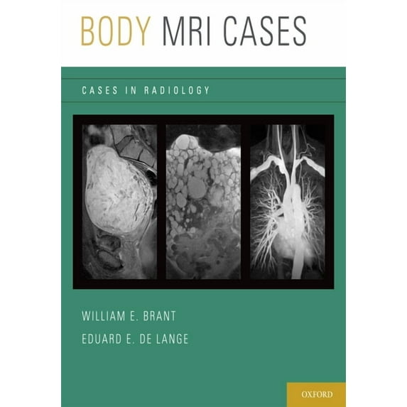Cases in Radiology Body MRI Cases, (Paperback)