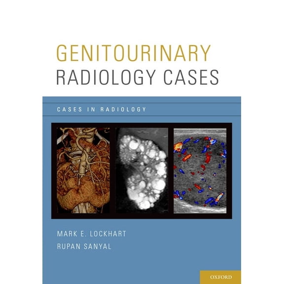 Cases in Radiology Genitourinary Radiology Cases Casrad P, (Paperback)