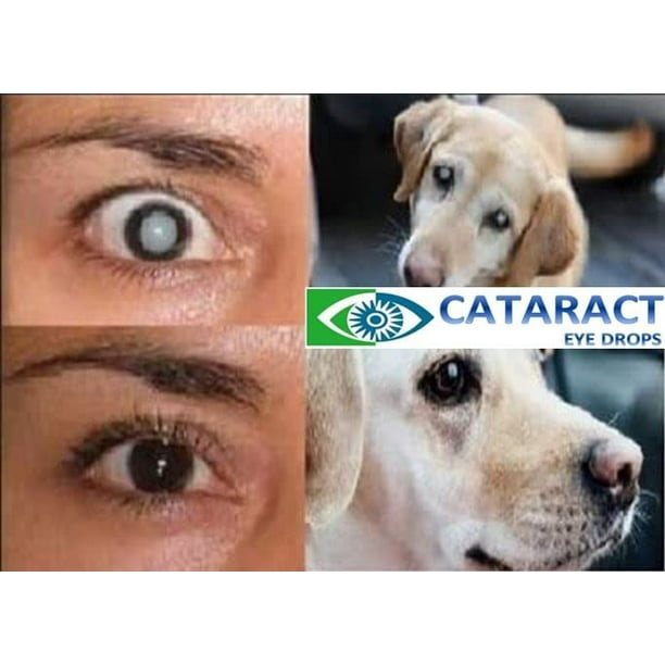 Cataract Clear 2 x 0.35fl oz (10ml) Bottles of Eye Drops. Contain Two
