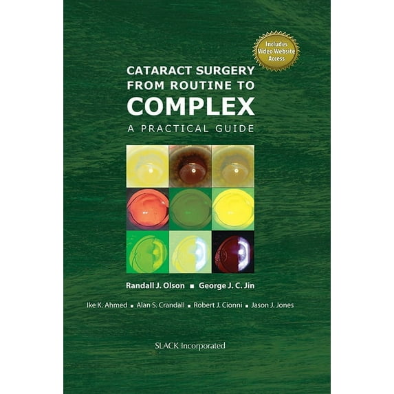 Cataract Surgery from Routine to Complex : A Practical Guide (Hardcover)