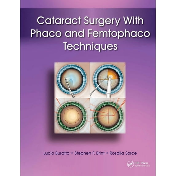 Cataract Surgery with Phaco and Femtophaco Techniques, (Hardcover)