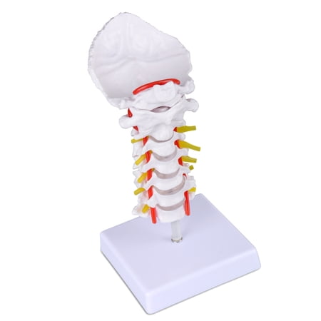 Cervical Spine Model with Cervical Vertebrae, Cervical Nerves, Vertebral Arteries & Occipital Plate