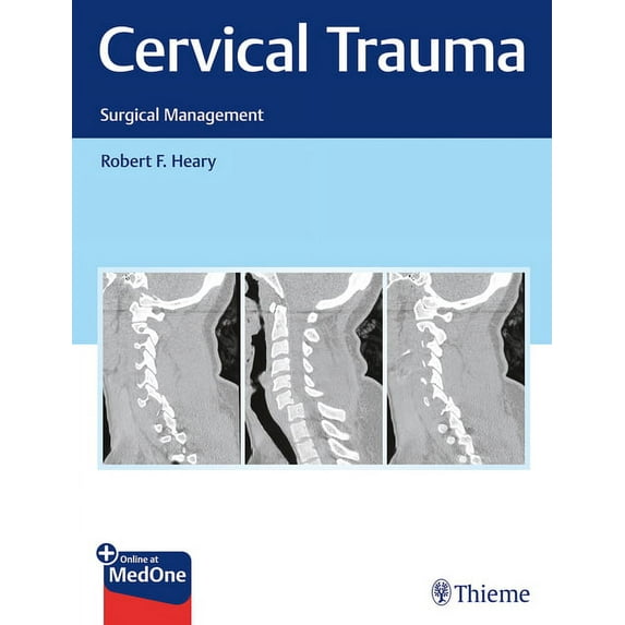 Cervical Trauma: Surgical Management (Hardcover)