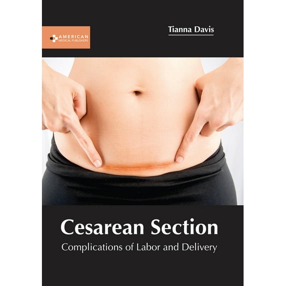 Cesarean Section: Complications of Labor and Delivery, (Hardcover)