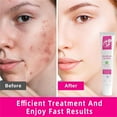 Chailin 2024 12 Azelaic Firming Azelaic Facial Redness Reduce Skin