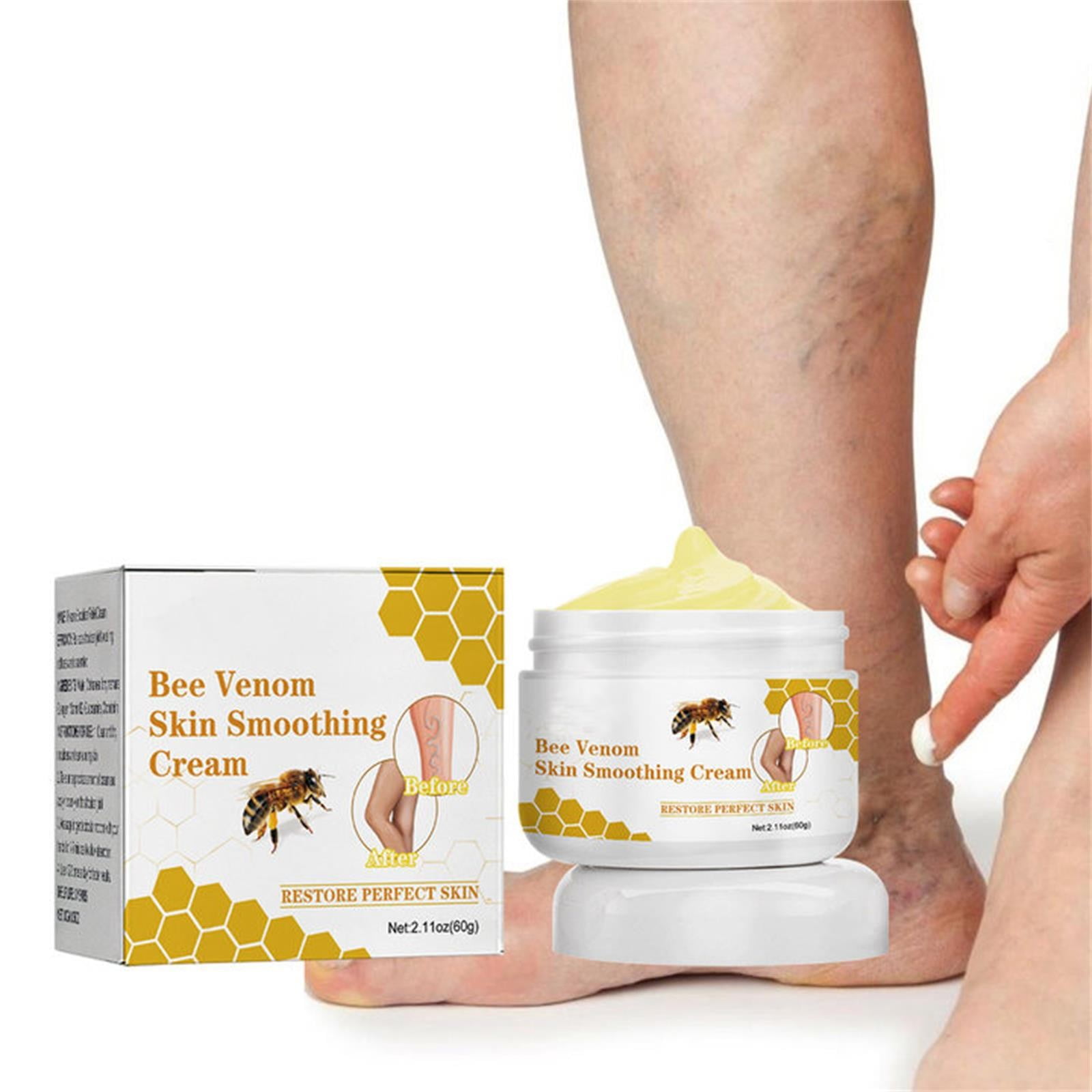 Chailin Varicose Veins Contains Natural Ingredients To Soothe Gently