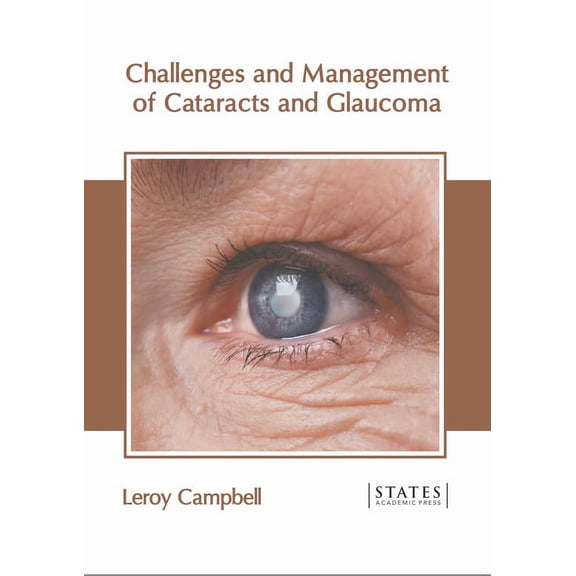 Challenges and Management of Cataracts and Glaucoma, (Hardcover)