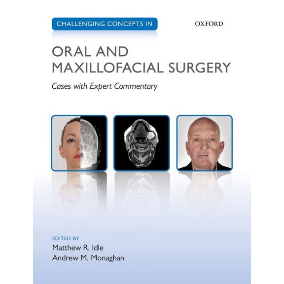 Challenging Cases Challenging Concepts in Oral and Maxillofacial Surgery: Cases with Expert Commentary, (Paperback)