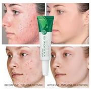 Chamoist Moisturizer Face Cream,LAIKOU Laikou Gel 20g Hydrating Moisturizing Skin Cream Lotion