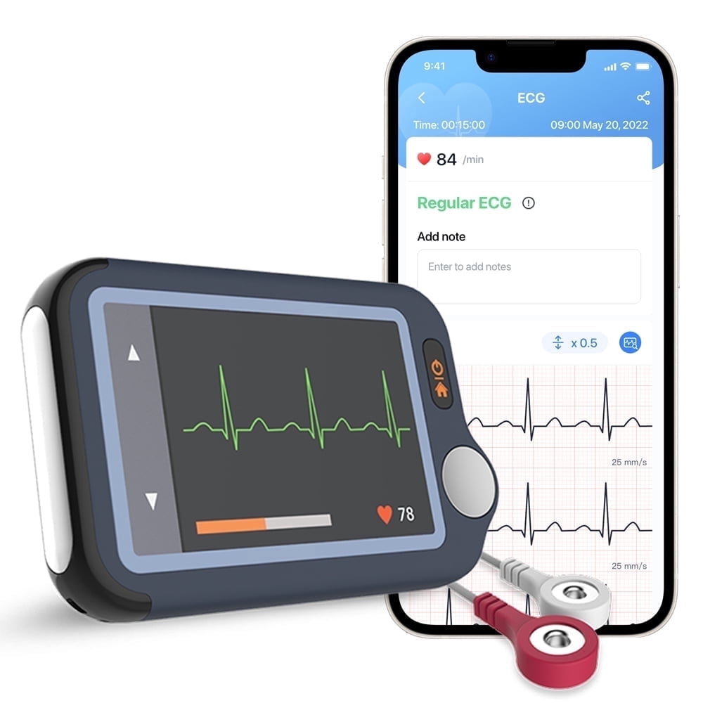 Wellue, ECG Monitor, 30s/60s/5min Recording, Compact, Black