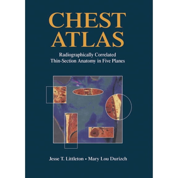 Pre-Owned Chest Atlas: Radiographically Correlated Thin-Section Anatomy in Five Planes (Hardcover 9780387979281) by Mary L Durizch, W C Lim, W P Callahan