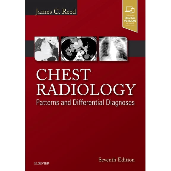 Chest Radiology