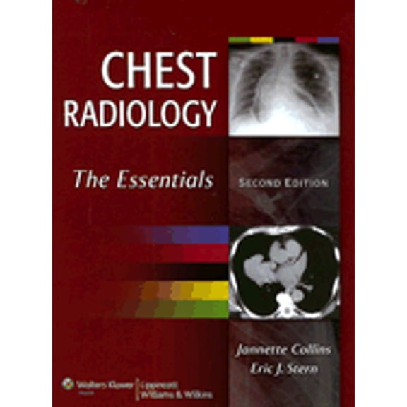 Pre-Owned Chest Radiology : The Essentials (Hardcover) 9780781763141
