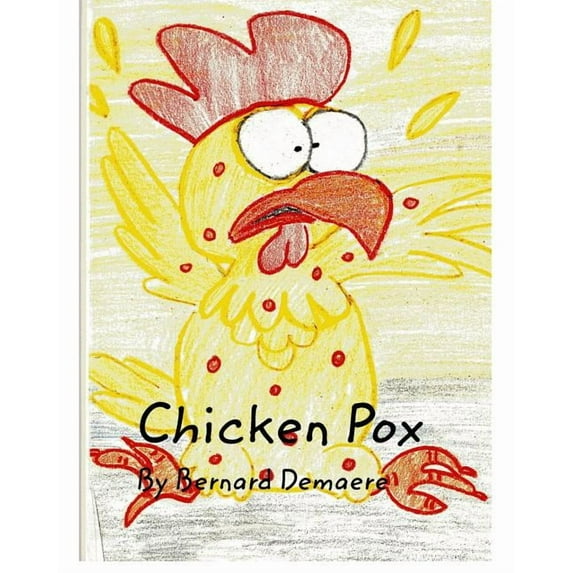 Chicken Pox, (Paperback)