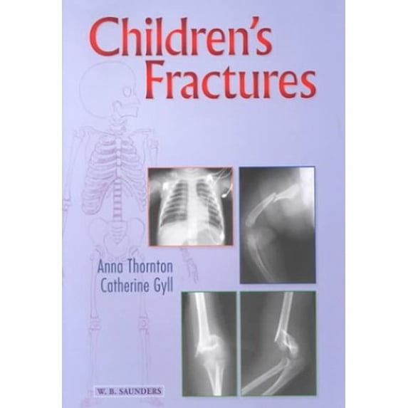 Pre-Owned Children's Fractures: A Radiological Guide to Safe Practice (Paperback) 0702021644 9780702021640