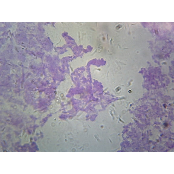 Chromosomes, Drosophila Melanogaster; Smear from Salivary Glands by Go Science Crazy