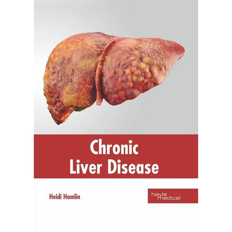 健康・医学 Gastrointestinal and Liver Disease 11th Sleisenger and Fordtran's Gastrointestinal and L: 11th