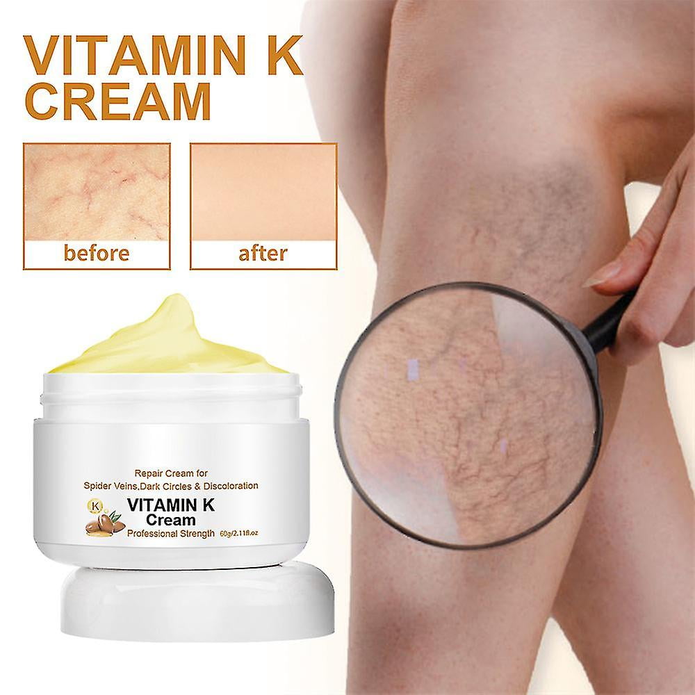 Circulheal Varicose Veins Miracle Cream, Varicose Vein Cream, Vitamin K