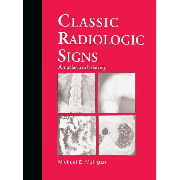 Classic Radiologic Signs: An Atlas and History, (Hardcover)