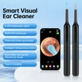 thumbnail image 1 of Smart Visual Ear Cleaner, 30W HD Ear Wax Removal Tool with 6 LED Lights, Type-C Charging, and Phone App Support, 1 of 16