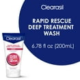 Clearasil Rapid Rescue Deep Treatment Acne Face Wash, Maximum Strenght