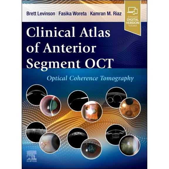 Pre-Owned Clinical Atlas of Anterior Segment OCT: Optical Coherence Tomography