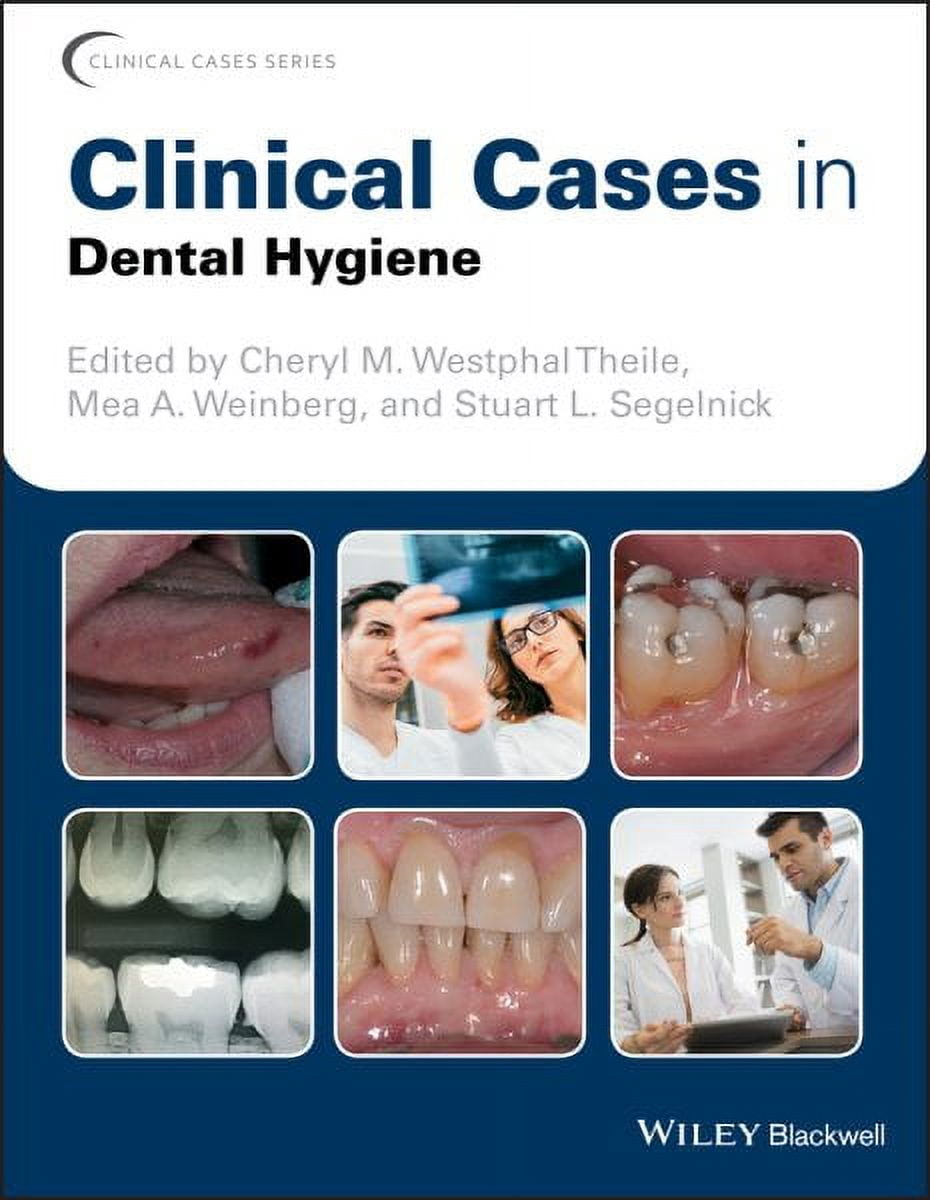 Clinical Cases (Dentistry): Clinical Cases in Dental Hygiene (Paperback ...