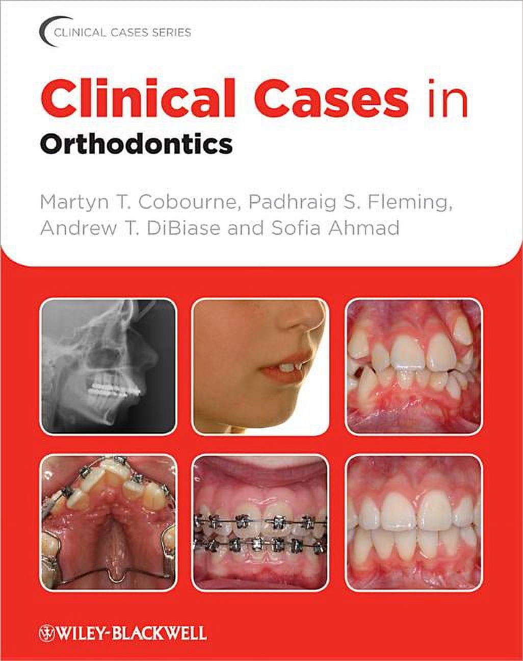 Clinical Cases (Dentistry) Clinical Cases in Orthodontics, Book 6, (Paperback)