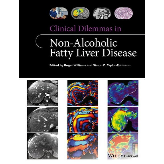 Clinical Dilemmas (UK) Clinical Dilemmas in Non-Alcoholic Fatty Liver Disease, (Paperback)