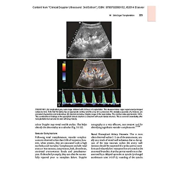 Pre-Owned Clinical Doppler Ultrasound, (Paperback)
